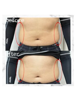 サロンドリシェス(Salon de RICHESSE)/最新痩身機器！