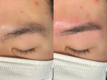 アイクイック 千石(Ai Quick)/メンズ眉毛/アイブロウ/千石/眉