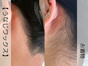 ウイ ネイルアンドビューティー(u'i nail&beauty)/お着物の後ろ姿に自信が持てる♪