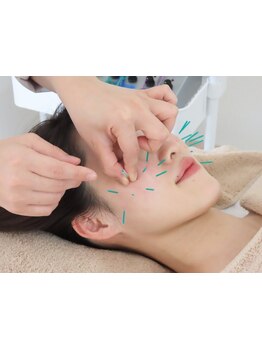 小顔になりたい