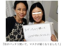 エピファニー(Epiphany)/顔の大きさが悩みでした…