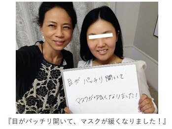 エピファニー(Epiphany)/顔の大きさが悩みでした…