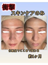 インチャント(enchant)/スキンケア診断・購入のみも可能