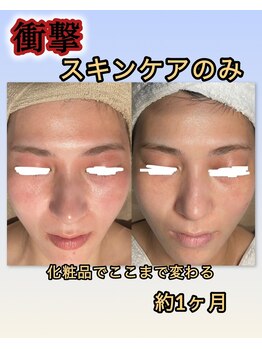 インチャント(enchant)/スキンケア診断・購入のみも可能