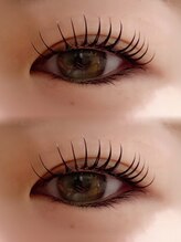 ミルリス(millelys)/アンドヘルシー/LEDエクパーマ