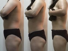 ビューティコア 二子玉川/ダイエットを卒業する痩身エステ