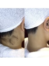 銀座シェービング 日本橋室町店/襟足美人！