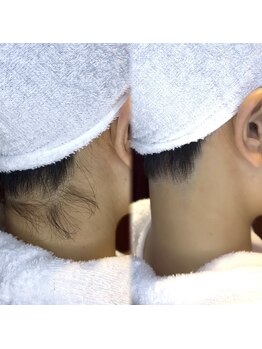 銀座シェービング 日本橋室町店/襟足美人！