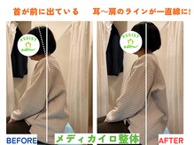 四条大宮アシスト鍼灸整骨院/全身整体ビフォーアフター