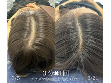 エレガ(ELEGA)の雰囲気（男女の頭皮・毛のお悩み改善！！）