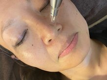 ヌーベルコピーヌ 2nd/小鼻の洗浄も♪