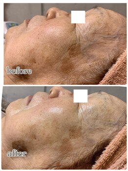 アロマ&クレイケアルーム ネロリドール(Nerolidol)/80代のお肌も♪