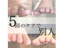 テトワ(Tetowa)