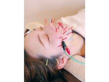 ミー(Mi)