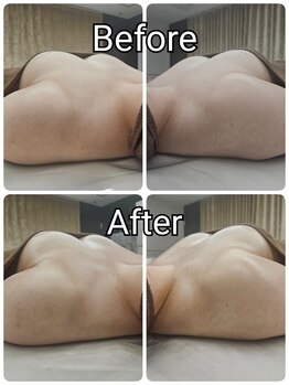 ルナリア ルクス 志木南口駅前店/ぷるぷるバストBefore/After