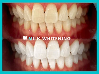 ミルクホワイトニング 久留米店(Milkホワイトニング)の写真