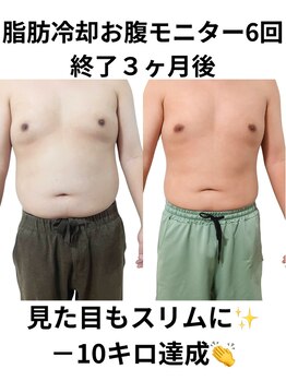 ホワイトビューティーラボ(White Beauty Lab)/お腹モニターで－10ｋｇ！！