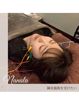 NANALA鍼灸　美容鍼×痩身強力もみだしマッサージの写真/鍼灸で全身アプローチ！痩身・肩凝り・小顔・毛穴に◎痩身マシン&強力もみだし！ヘッドマッサージも♪