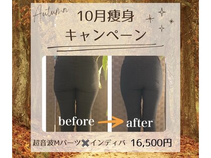 リム ビューティー(RYM BEAUTY)の写真