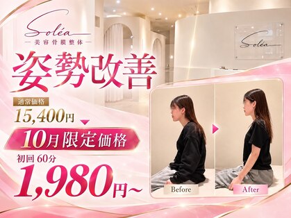 ソレア(Solea)の写真