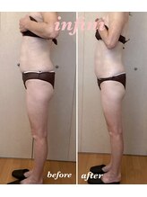 アンフィニ(infini)/短期集中全身5回コース（2ヶ月)