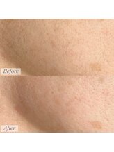 ビエン(Bien)/フェイシャルワックス