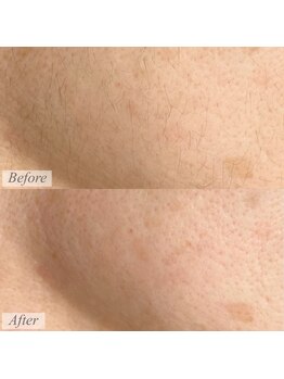 ビエン(Bien)/フェイシャルワックス