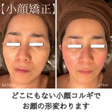 シャラ(shara)