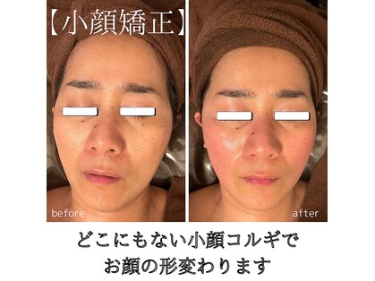 シャラ(shara)の写真