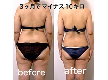 エステサロンクオーツ