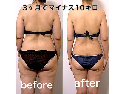 エステサロンクオーツの写真