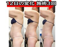 コンフィデンス 谷町四丁目店(Confidence)/後ろ姿美人