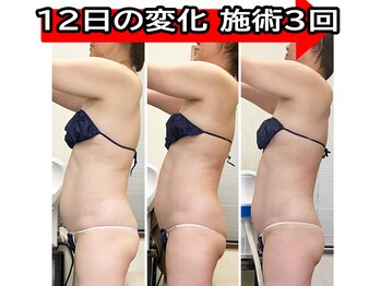 コンフィデンス 谷町四丁目店(Confidence)/後ろ姿美人