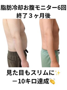 ホワイトビューティーラボ(White Beauty Lab)/お腹モニターでー１０ｋｇ！！