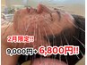【人気No.3】シワ・たるみ/肌質改善に◎鬼美容鍼9000→6800円 通常美容鍼も可