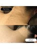短期集中ブライダルパック　3回