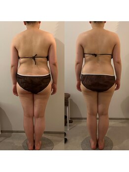 ラナ 京都西院店(Lana)/体の歪み改善！姿勢＆血流改善