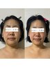 1番人気◆美肌、たるみ、小顔に！毎月のお手入れfacial 60min ¥15400→¥11000