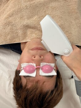 フロンティア/全顔脱毛　施術風景