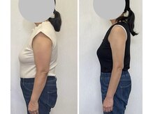 時空箱(ときのはこ)/【3か月/６回施術後】