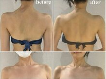 サロン ド ブラン アオヤマ(Salon de BLANC AOYAMA)/ブライダルエステ