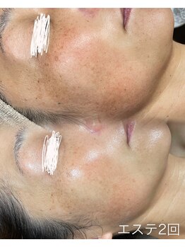 インチャント(enchant)/2ヶ月。ここまで変わる