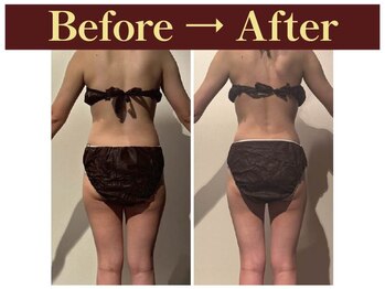 グレースフルタイム プレミアム(Graceful Time PREMIUM)/ビフォーアフター