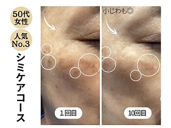 グラツィア(Grazia)/透明肌を作るシミ対策コース