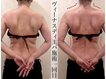 イーメイ(YIMEI)/オイルリンパマサージソウシン