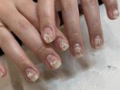 フィルイン施術/持ち込み