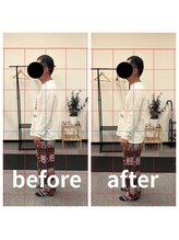 熊本カワル整体 JR上熊本駅院/ストレートネック