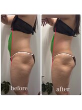 セリーナ 伊賀上野店(CELINA)/20代　痩身エステ