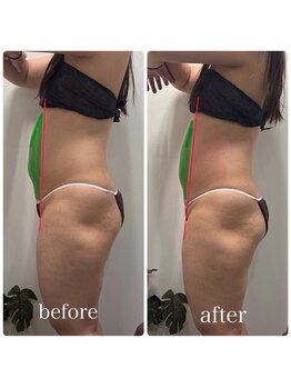 セリーナ 伊賀上野店(CELINA)/20代 痩身エステ