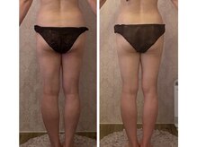 ルポーゼ(Repose)/